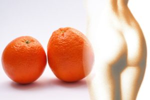 Jak se zbavit celulitidy? Přinášíme několik tipů a rad